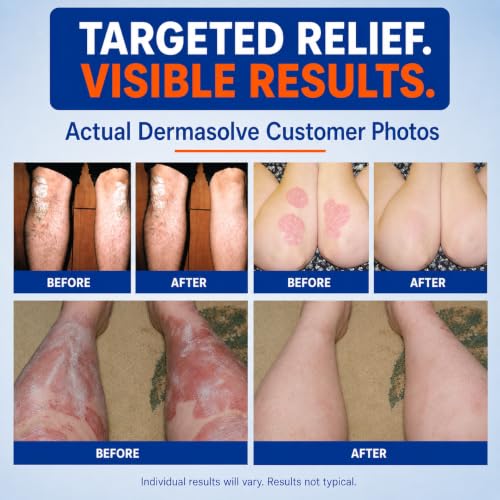 Medicated Psoriasis Body Wash - 2-Pack (