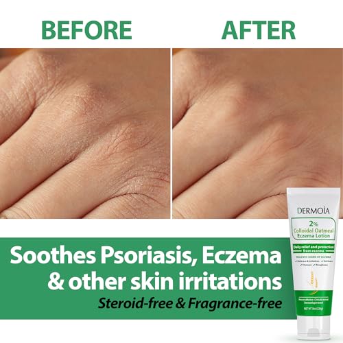 2% Colloidal Oatmeal Eczema Lotion - Soothing and Moisturizing Anti-Itch Cream & Body Loti