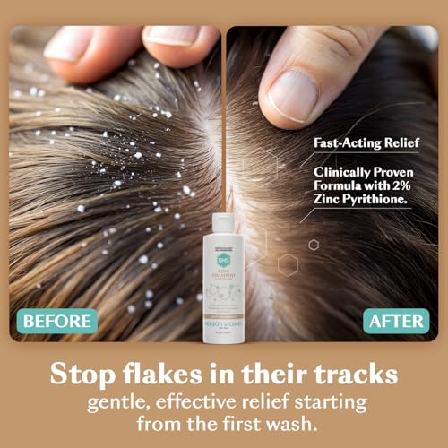 Zinc Shampoo