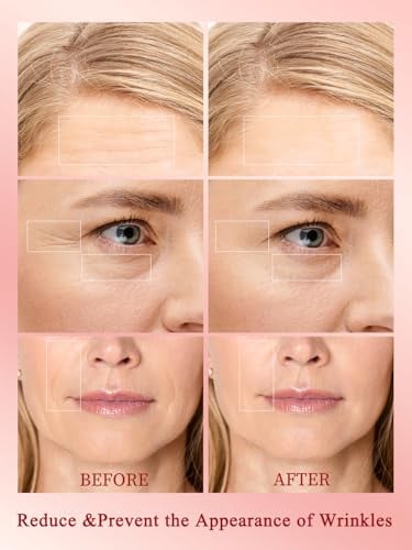 Radio Frequency Skin Tightening Device Anti-Aging Face Machine