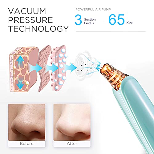 Blackhead Remover Pore Vacuum Cleaner USB 5 Probes