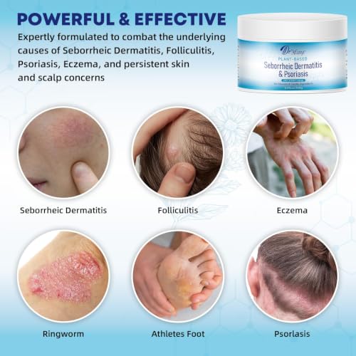 Seborrheic Dermatitis Care Cream - Dry Scalp Face & Body Moisturizer with Anti Itch & Dand