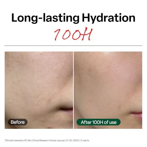 R.E.D. Blemish Clear Soothing Face Cream