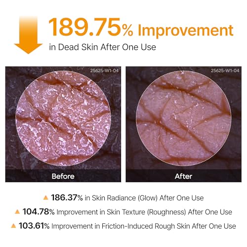 Peel Shot Kojic Acid Turmeric Body Exfoliator Spray