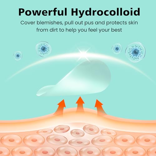563 Count Hydrocolloid Acne Patches Face Body