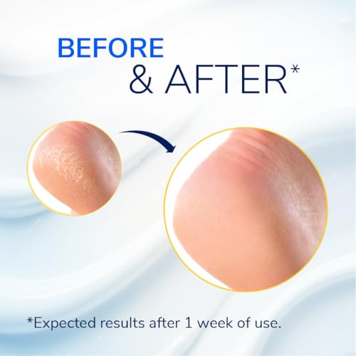 Severe Cracked Heel Repair Restoring Balm 2.5oz