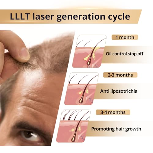 Hair Growth Device 650-660nm Laser Red Light Therapy Cap