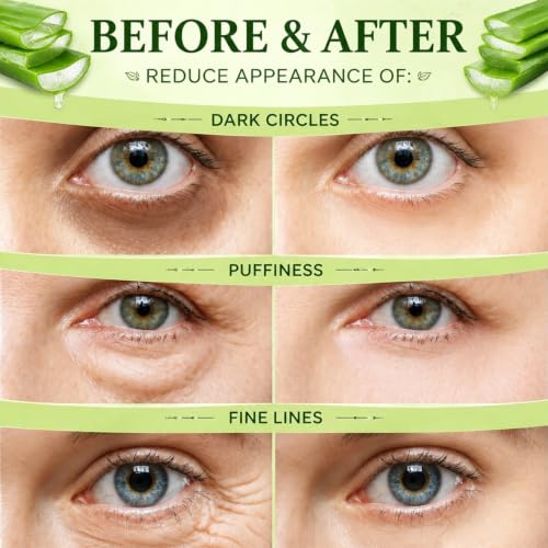 Aloe Under Eye Patches, 60 pcs