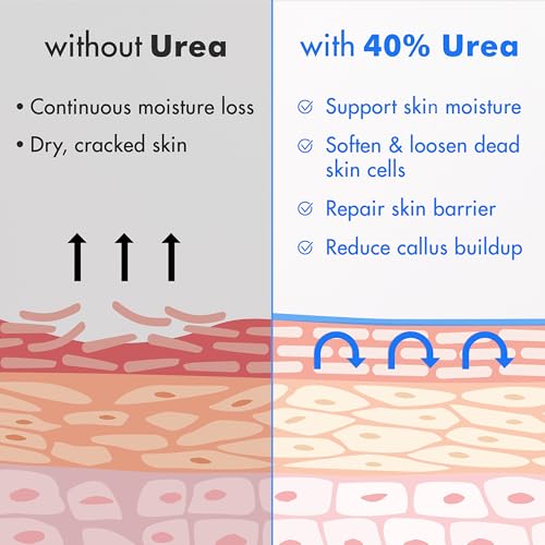 Urea Cream 40% plus Salicylic Acid 2% for Dry Cracked Feet Skin
