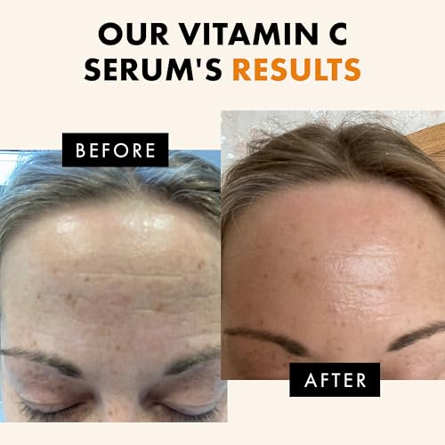Vitamin C Serum