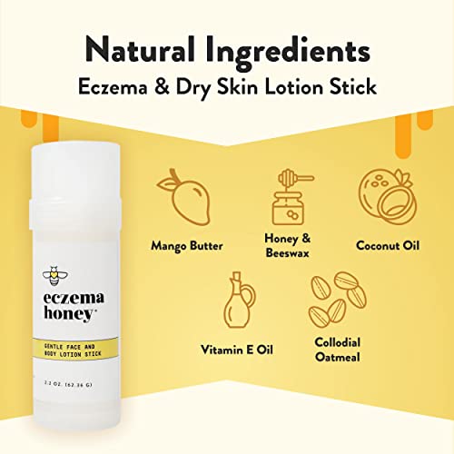 Gentle Face & Body Lotion Stick for Psoriasis & More (