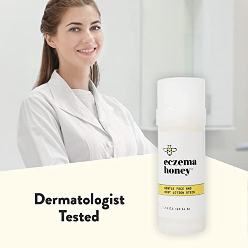 Gentle Face & Body Lotion Stick for Psoriasis & More (