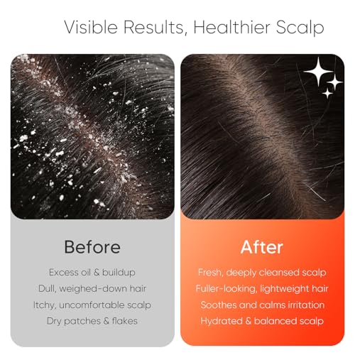 Sonic Vibrating Scalp Massager Shampoo Brush Electric Silicone
