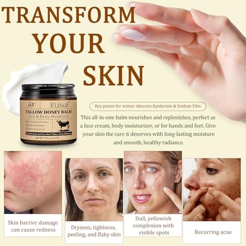 Whipped Tallow Cream for Face & Body