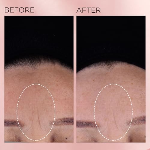 Retinol Ceramide Capsules