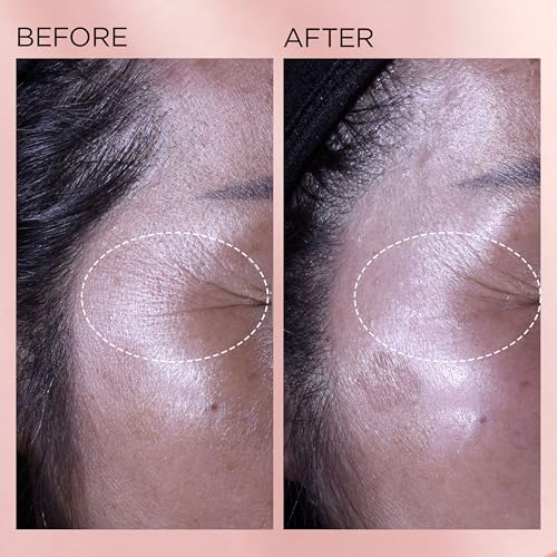 Retinol Ceramide Capsules