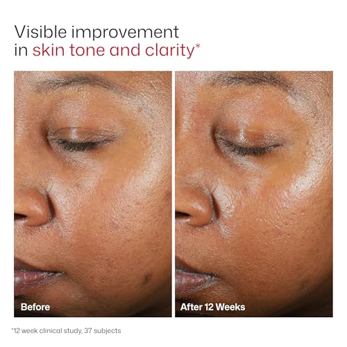 UV Clear Tinted Broad-Spectrum SPF 46