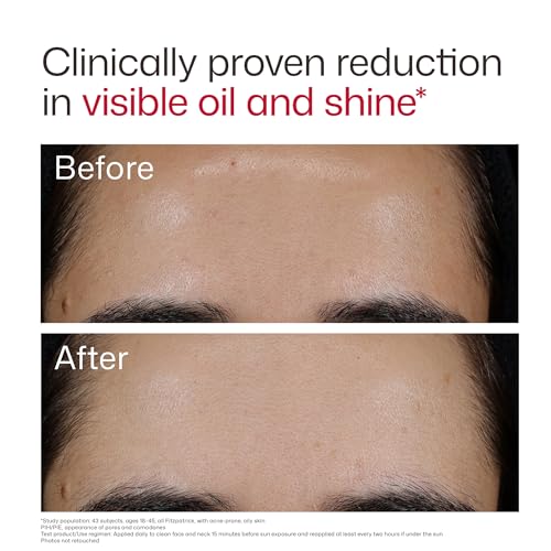 UV Clear Blemish-Prone SPF 50