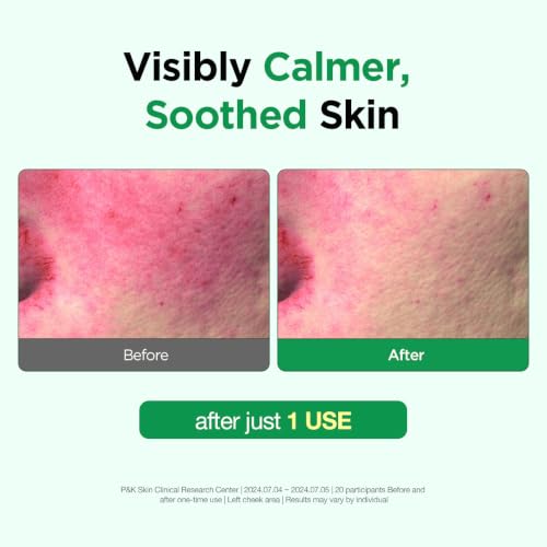 Tea Tree Relief Foam Cleanser