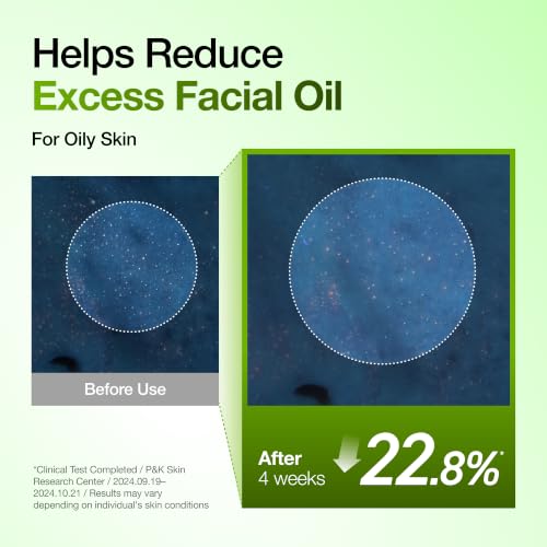 Anua Azelaic Acid 10 Hyaluron Redness Soothing Serum