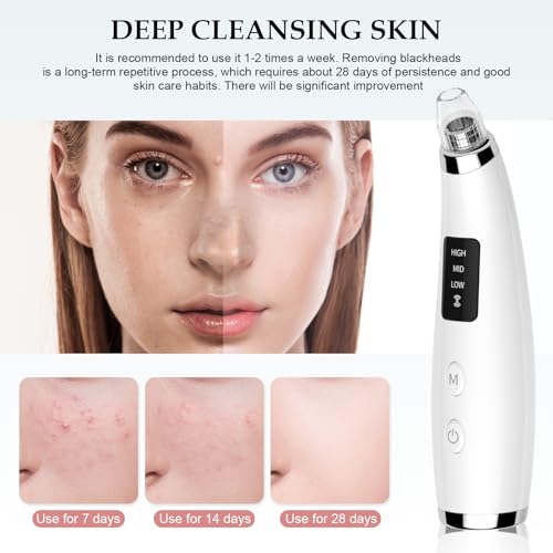 Blackhead Remover Pore Vacuum 5 Attachments 3 Suction Levels White