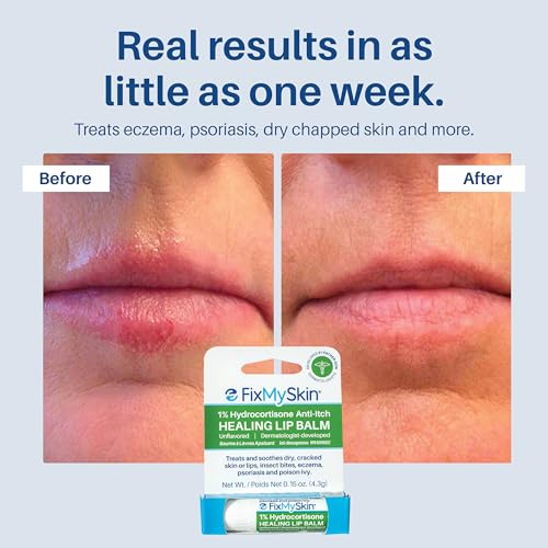 1% Hydrocortisone Healing Lip Balm