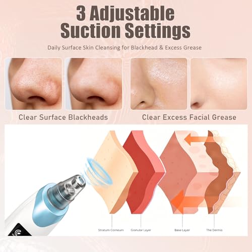 Blackhead Remover Pore Vacuum Facial Pore Cleaner Blue