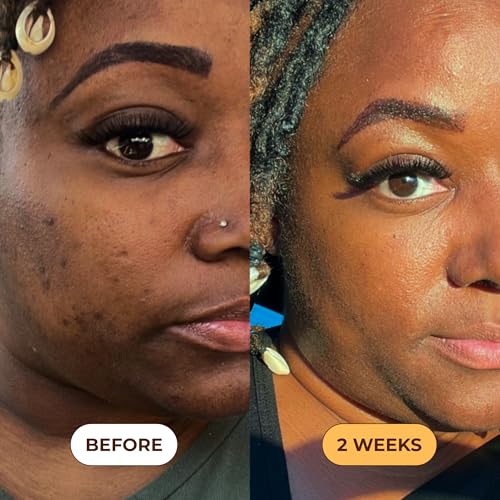 Turmeric Body Scrub for Dark Spots