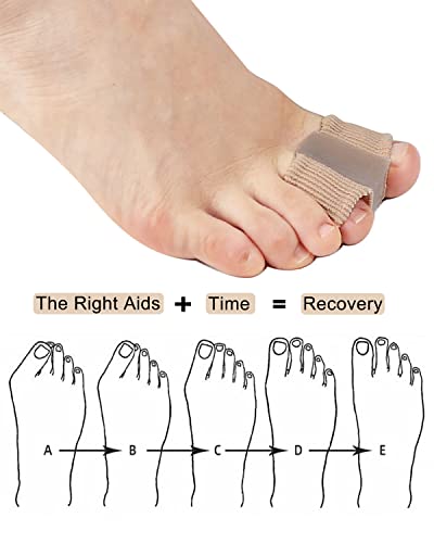 Bunion Toe Separators Bunion Corrector Spacers for Women Big Toe