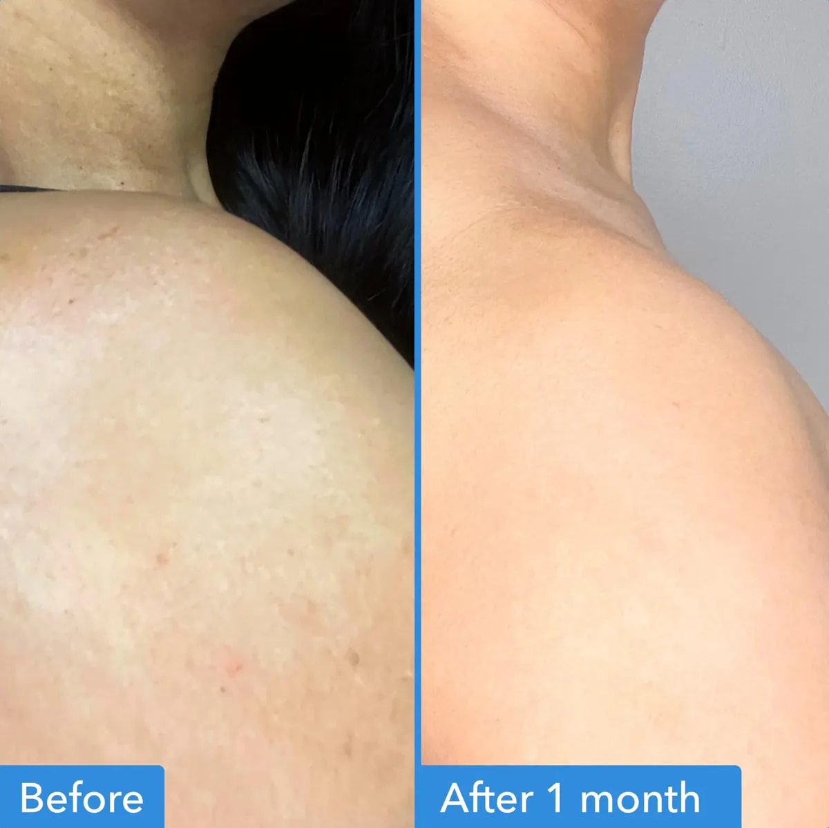 Discoloration Correcting Body Treatment