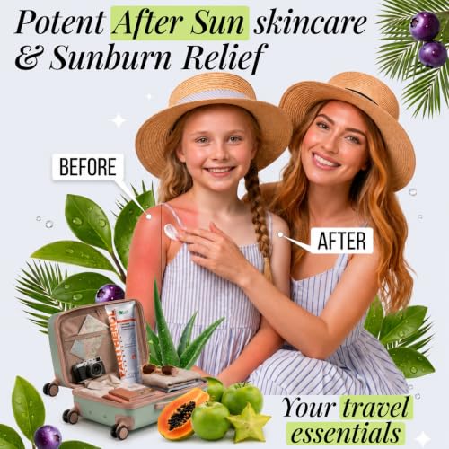 Barrier Repair Cream with 9% Panthenol & Aloe - Soothing Healing Moisturizer for Face & Bo