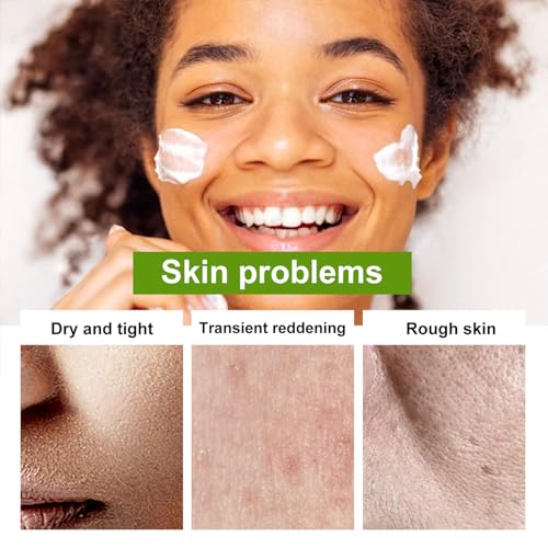 Aloe Vera Moisturizer Facial Cream,Facial Cream With 98% Organic Aloe Ve