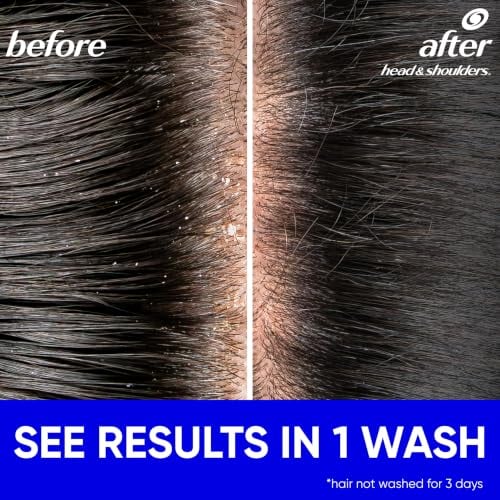 Classic Clean Anti-Dandruff Shampoo