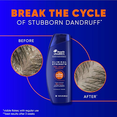 Clinical Strength Anti-Dandruff Shampoo with 1% Selenium Sulfide
