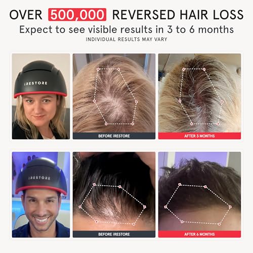 Elite Laser Red Light Therapy Hair Growth System FDA Cleared