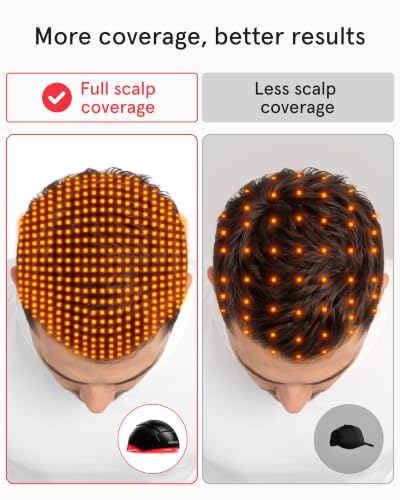 Elite Laser Red Light Therapy Hair Growth System FDA Cleared