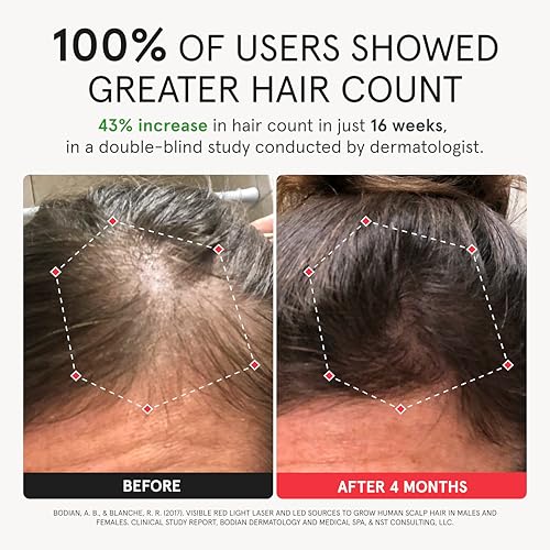 Elite Laser Red Light Therapy Hair Growth System FDA Cleared