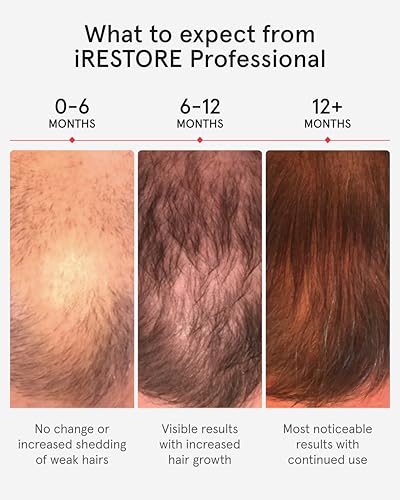 Professional Laser Red Light Therapy Hair Growth System FDA Cleared