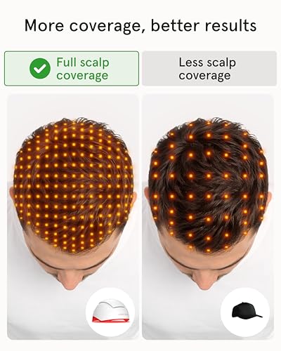 Professional Laser Red Light Therapy Hair Growth System FDA Cleared
