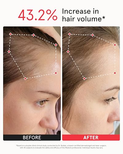 Professional Laser Red Light Therapy Hair Growth System FDA Cleared