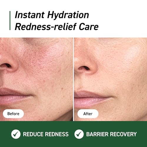 Cica Redness Relief Treatment Cream