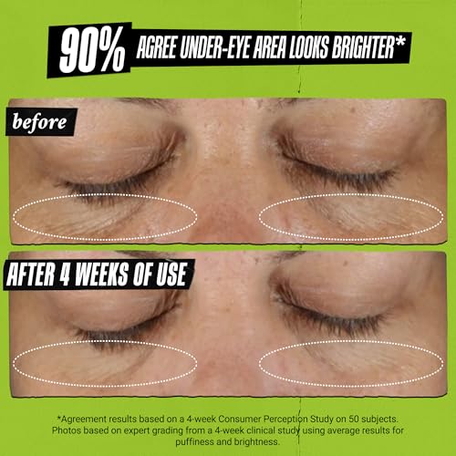 Creamy Eye Treatment with Avocado