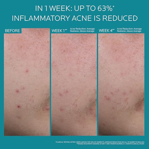 Effaclar BPO 5% Benzoyl Peroxide