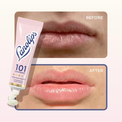 Lanolin 101 Multipurpose Ointment - Lanolin Lip Balm