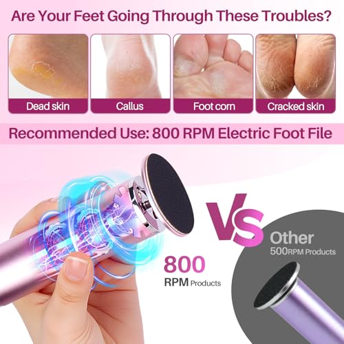 Electric Foot Callus Remover Adjustable Speed Foot File