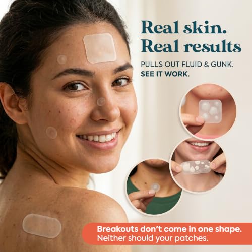 272 CT Large Pimple Patches 10 Sizes Salicylic
