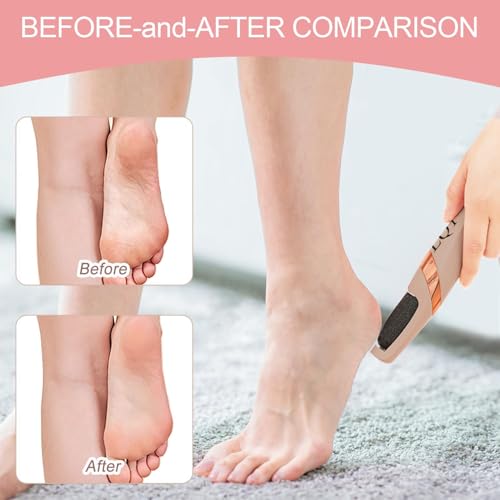 Electric Foot File Rechargeable Callus Remover Hard Cracked Skin Pink