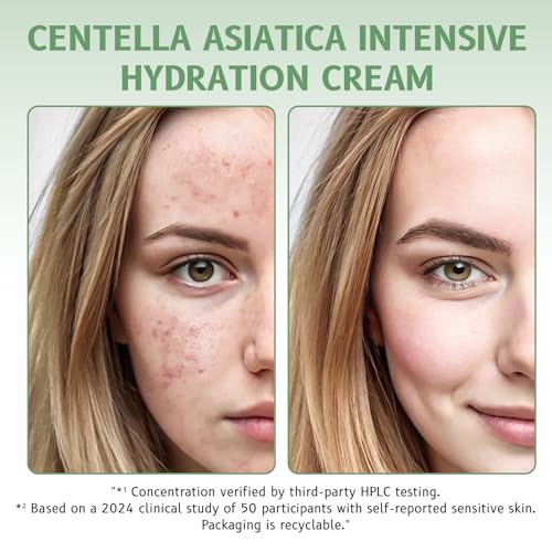 Centella Asiatica Cream for Sensitive Skin