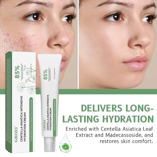 Centella Asiatica Cream for Sensitive Skin