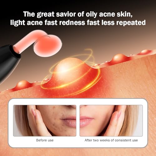 OxyGlow 2 Cordless High Frequency Facial Wand Face and Scalp